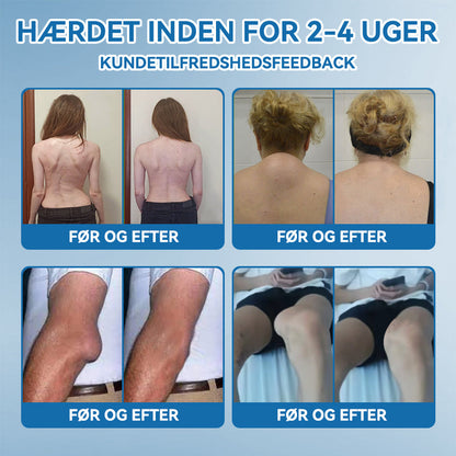 𝐎𝐟𝐟𝐢𝐜𝐢𝐞𝐥 𝐛𝐮𝐭𝐢𝐤 | 𝖯𝗂𝖼𝗱𝗼® 👩‍⚕️𝐁𝐏𝐂-𝟏𝟓𝟕 𝐅æ𝐥𝐥𝐞𝐬 𝐇𝐞𝐥𝐞𝐧𝐝𝐞 𝐂𝐫𝐞𝐦𝐞🦴Behandler gigt, neuropati, reumatisme, sportsskader og mere👍