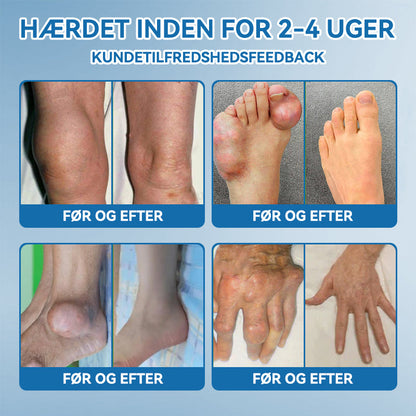 𝐎𝐟𝐟𝐢𝐜𝐢𝐞𝐥 𝐛𝐮𝐭𝐢𝐤 | 𝖯𝗂𝖼𝗱𝗼® 👩‍⚕️𝐁𝐏𝐂-𝟏𝟓𝟕 𝐅æ𝐥𝐥𝐞𝐬 𝐇𝐞𝐥𝐞𝐧𝐝𝐞 𝐂𝐫𝐞𝐦𝐞🦴Behandler gigt, neuropati, reumatisme, sportsskader og mere👍