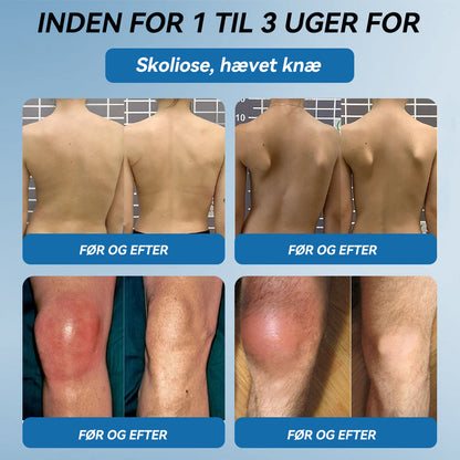 𝐎𝐟𝐟𝐢𝐜𝐢𝐞𝐥 𝐛𝐮𝐭𝐢𝐤 | 𝖯𝗂𝖼𝗱𝗼® 👩‍⚕️𝐁𝐏𝐂-𝟏𝟓𝟕 𝐅æ𝐥𝐥𝐞𝐬 𝐇𝐞𝐥𝐞𝐧𝐝𝐞 𝐂𝐫𝐞𝐦𝐞🦴Behandler gigt, neuropati, reumatisme, sportsskader og mere👍
