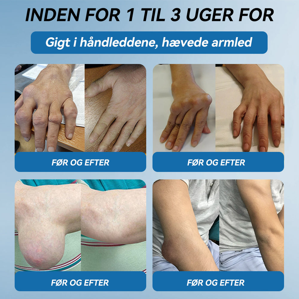 𝐎𝐟𝐟𝐢𝐜𝐢𝐞𝐥 𝐛𝐮𝐭𝐢𝐤 | 𝖯𝗂𝖼𝗱𝗼® 👩‍⚕️𝐁𝐏𝐂-𝟏𝟓𝟕 𝐅æ𝐥𝐥𝐞𝐬 𝐇𝐞𝐥𝐞𝐧𝐝𝐞 𝐂𝐫𝐞𝐦𝐞🦴Behandler gigt, neuropati, reumatisme, sportsskader og mere👍