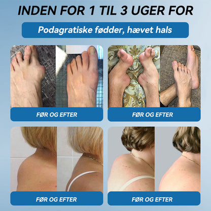 𝐎𝐟𝐟𝐢𝐜𝐢𝐞𝐥 𝐛𝐮𝐭𝐢𝐤 | 𝖯𝗂𝖼𝗱𝗼® 👩‍⚕️𝐁𝐏𝐂-𝟏𝟓𝟕 𝐅æ𝐥𝐥𝐞𝐬 𝐇𝐞𝐥𝐞𝐧𝐝𝐞 𝐂𝐫𝐞𝐦𝐞🦴Behandler gigt, neuropati, reumatisme, sportsskader og mere👍